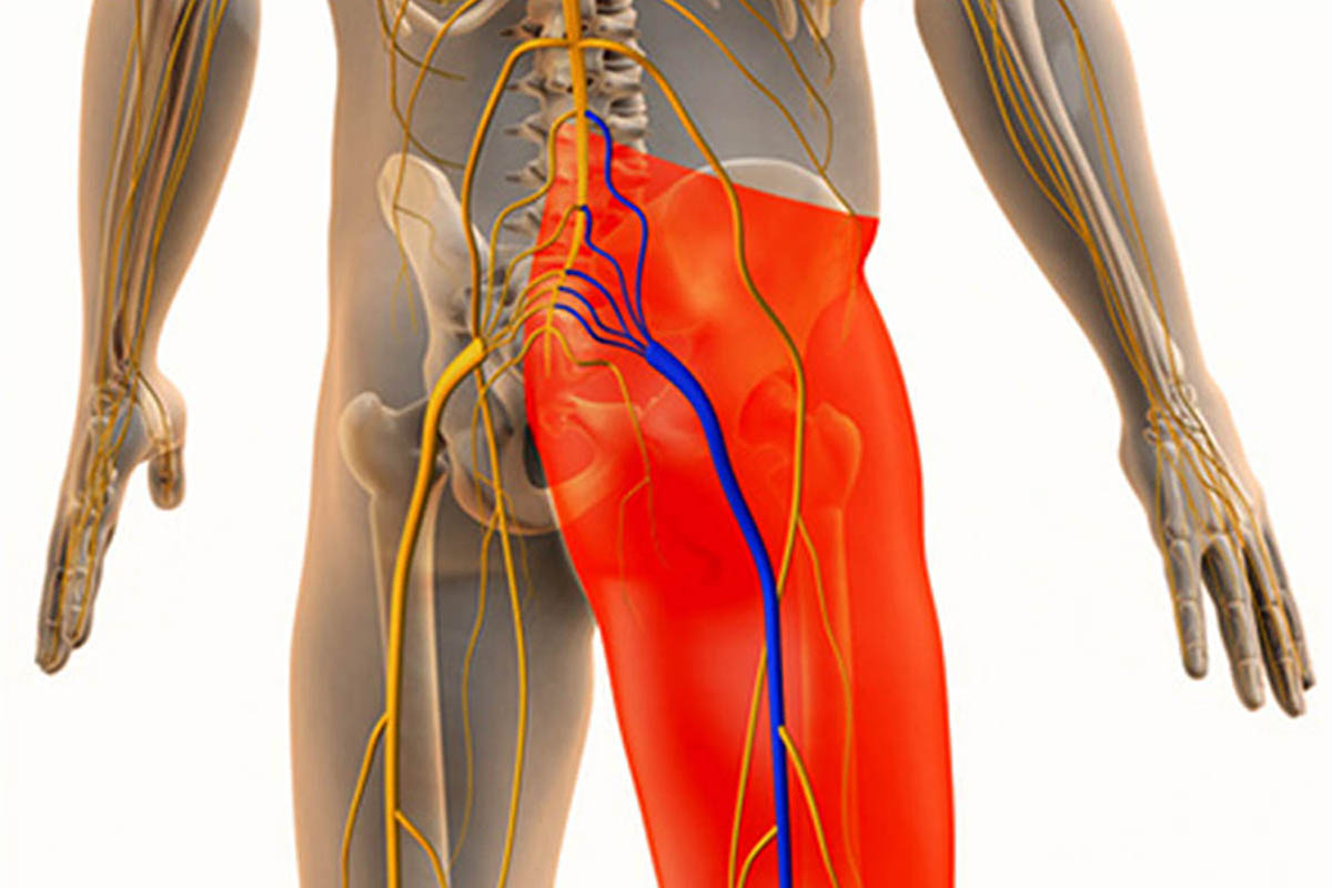 Signs of Sciatica Pain Improving & the Phases of Recovery