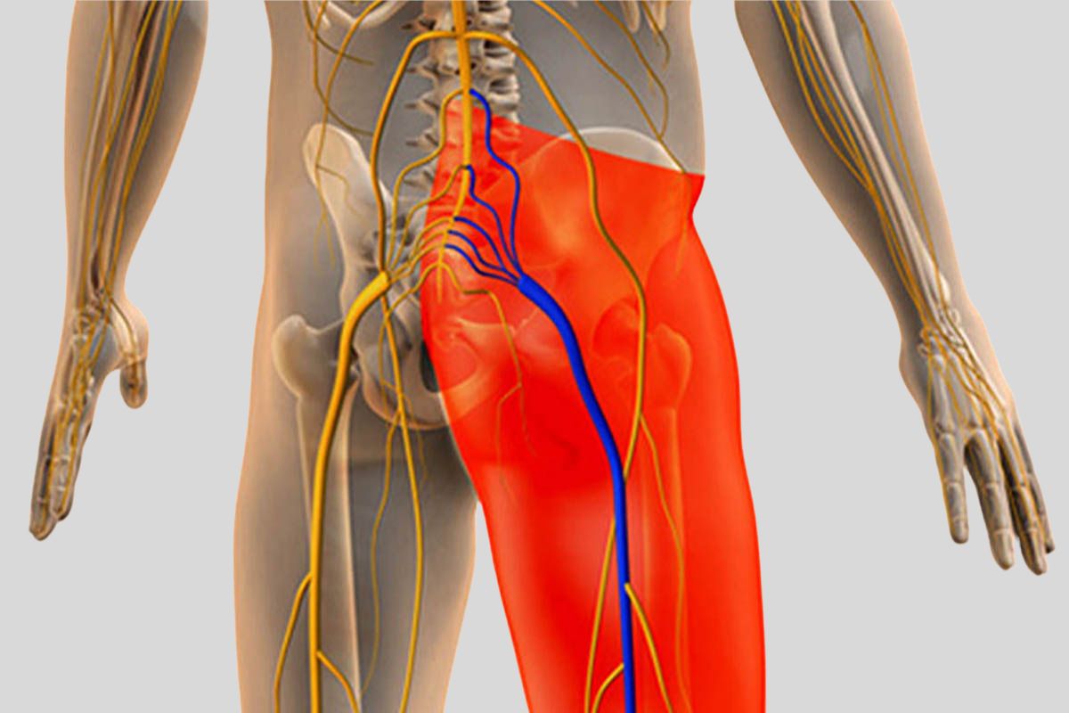 Symptoms of Sciatica Flare Up